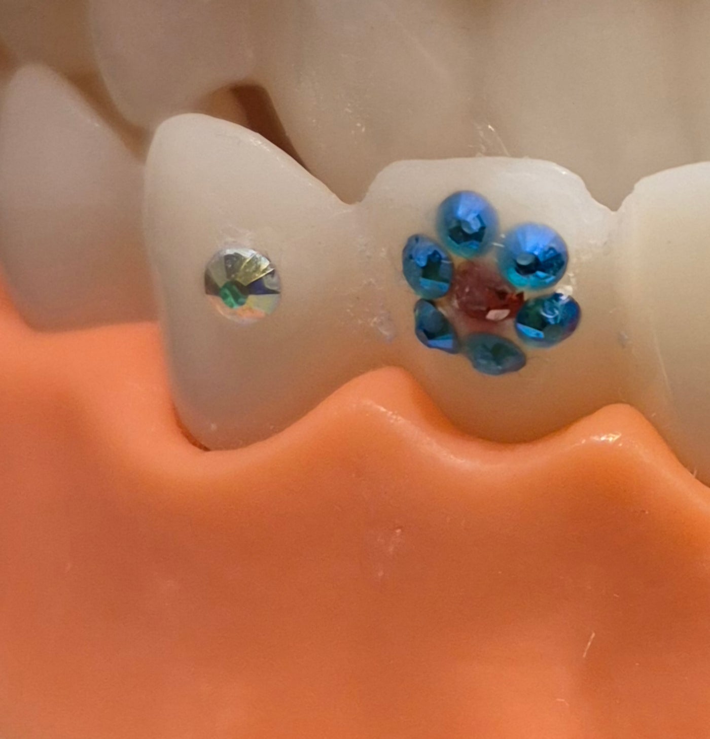 Tooth Gems at DDC WRAPS