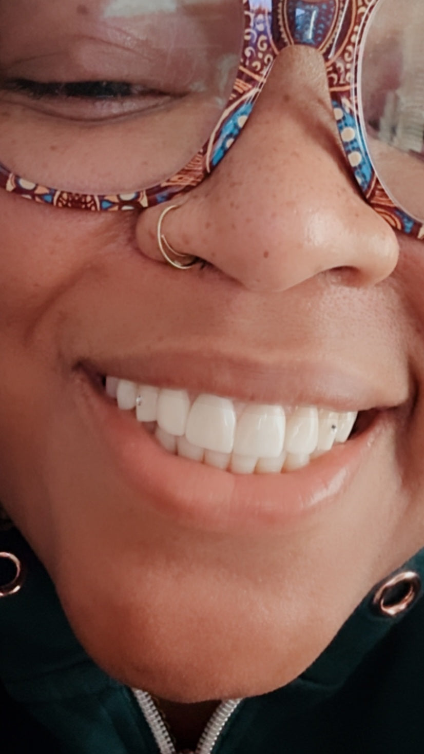 Tooth Gems at DDC WRAPS